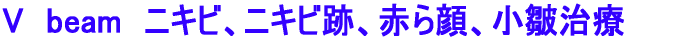 V�@beam�@�j�L�r�A�j�L�r�ՁA�Ԃ��A��ᰎ���